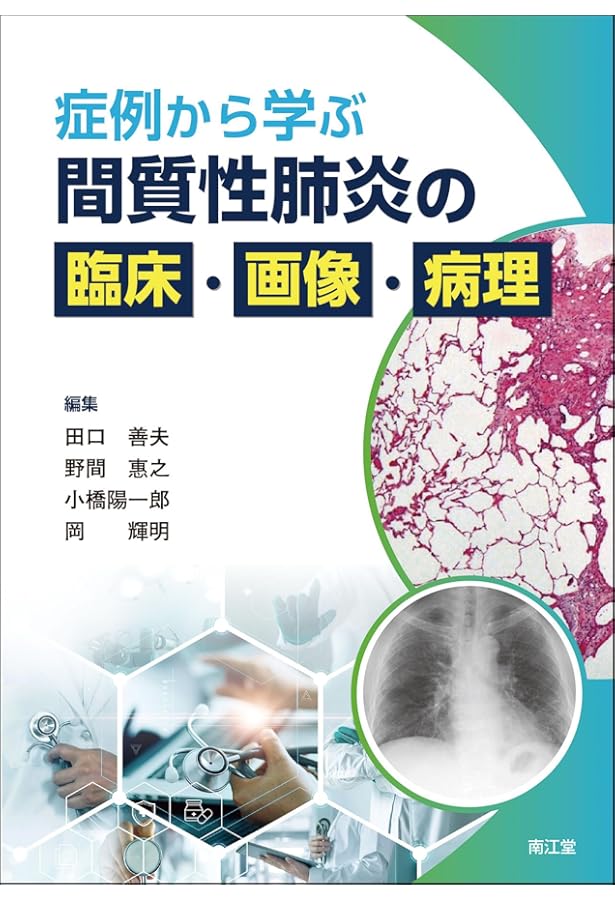 間質性肺炎のみかた，考えかた | 喜舎場 朝雄 |本 | 通販 | Amazon